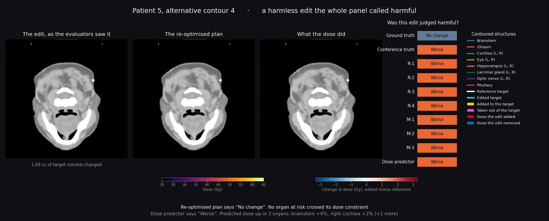 Four panels: an axial CT slice with the reference target contour in white and an edited one in cyan, the edited region filled yellow; the re-optimised dose plan as a heat map; the change in dose as a red and blue diverging map; and a strip of coloured verdicts in which every judge says the edit was harmful while the ground truth says it was not.